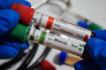 Vitamins - Test and Minerals Test with blood sample. Top view isolated on office desk. Healthcare or Medical concept