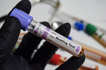 Sickling - Test with blood sample. Top view isolated on office desk. Healthcare or Medical concept