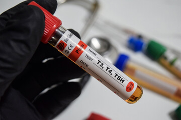 T3, T4, TSH - Test with blood sample. Top view isolated on office desk. Healthcare or Medical...