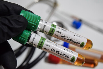 HDL Cholesterol - Test and LDL Cholesterol - Test with blood sample. Top view isolated on office desk. Healthcare or Medical concept