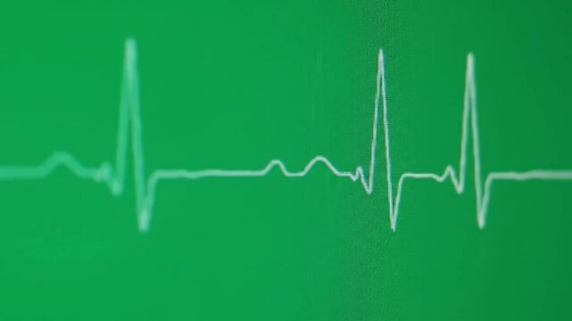 "Flatline to Heartbeat Revival ECG Animation | Green Screen Emergency Scene for Cinematic, Medical, or Rescue Use"