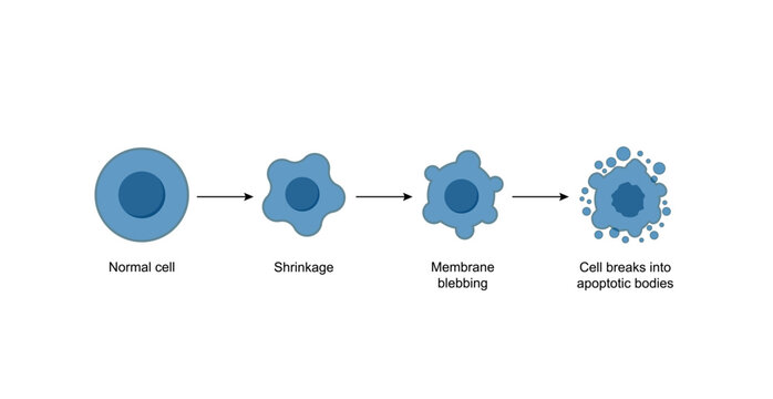 Apoptosis. Programmed cell death. Aging process in cells. Stages of apoptosis, normal cell, shrinkage, membrane blebbing, cell breaks into apoptotic bodies and phagocytosis. Vector illustration.