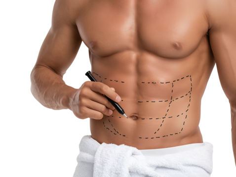 Man torso with cosmetic surgery markings isolated on transparent or white background, png