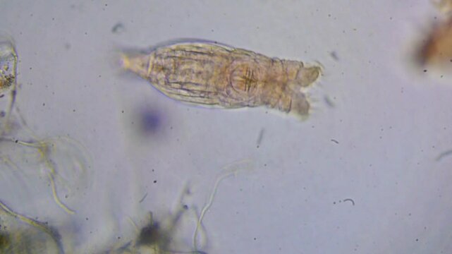 Two large rotifers pass by another rotifer of a smaller size within aquatic habitat.