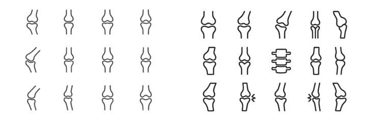 Variations of knee joint illustrations showing different orientations and conditions in a medical diagram for educational purposes