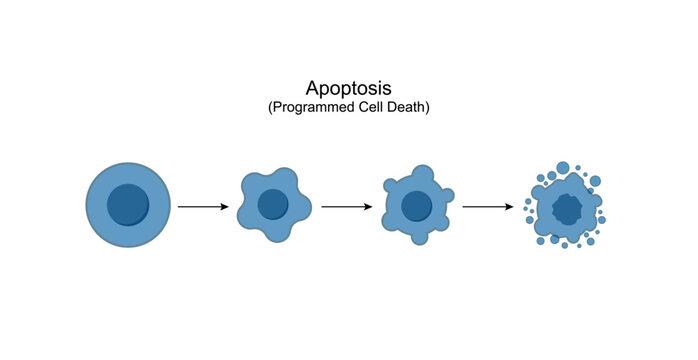 Apoptosis. Programmed cell death. Aging process in cells. Stages of apoptosis, normal cell, shrinkage, membrane blebbing, cell breaks into apoptotic bodies and phagocytosis. Vector illustration.