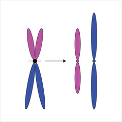 Chromosomal abnormalities Isochromosome