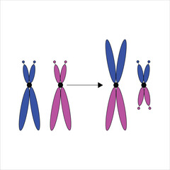 Chromosome exchange - Robertsonian translocation