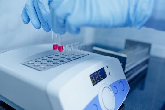Lab Technician Handling Blood Test Tubes in Digital Analyzer for Medical Diagnostics and Clinical Research
