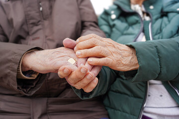 An elderly matrimony hands with rheumatoid arthritis