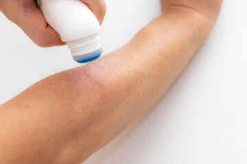虫に刺されて腫れた腕に薬を塗る