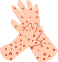 Hands Covered in Red Spotted Rash
