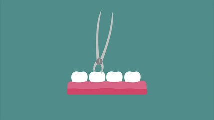 Tooth extraction with dental forceps. Dental healthcare animation concept in flat design on turquoise background. 