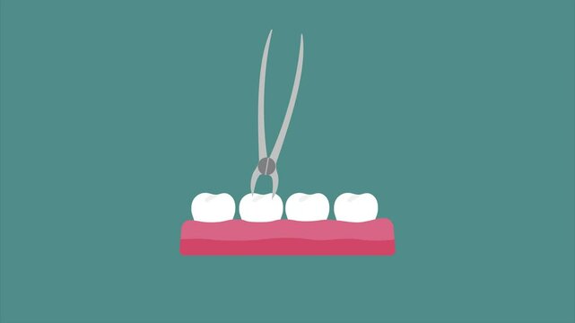 Tooth extraction with dental forceps. Dental healthcare animation concept in flat design on turquoise background. 
