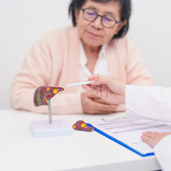 Doctor with human Liver anatomy. Elderly Patient consultation medical health for Liver cancer and Tumor, Jaundice, Viral Hepatitis, Cirrhosis, Failure, Enlarged, Hepatic Encephalopathy, Ascites Fluid