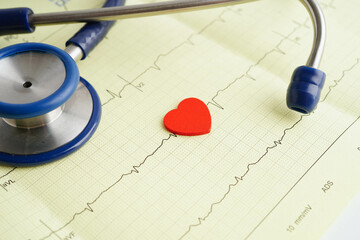 Stethoscope on electrocardiogram ECG, heart wave, heart attack, cardiogram report.