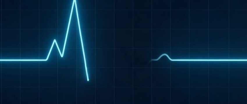 Lifesign Cardio Lifesign Images – Browse 104 Stock Photos, Vectors, and Video | Adobe Stock
