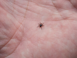 Tick on human skin, showing caution and concern, with bright sunflower background