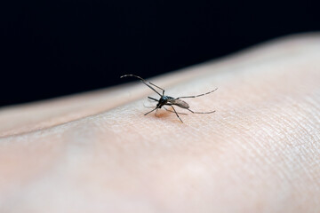 蚊に手を刺されている写真