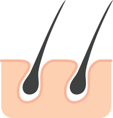 피부 모낭의 단면을 표현한 일러스트