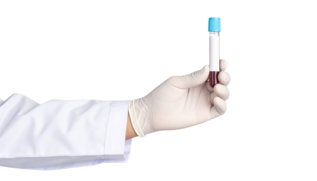 A gloved hand holds a test tube containing a blood sample with a blue cap. - Powered by Adobe