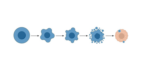Apoptosis. Programmed cell death. Aging process in cells. Stages of apoptosis, normal cell, shrinkage, membrane blebbing, cell breaks into apoptotic bodies and phagocytosis. Vector illustration.