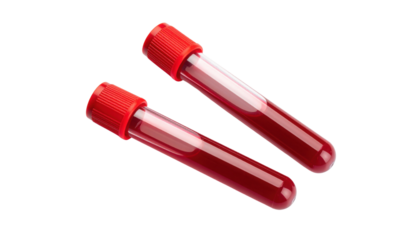 Two blood collection tubes with red caps filled with blood, designed for medical testing and laboratory analysis.