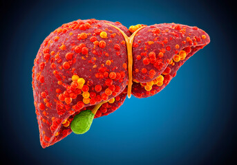 3D-Rendered Fatty Liver: Cellular Structure Revealed