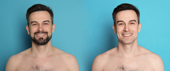 Handsome man before and after shaving on light blue background, collage of photos. Banner design
