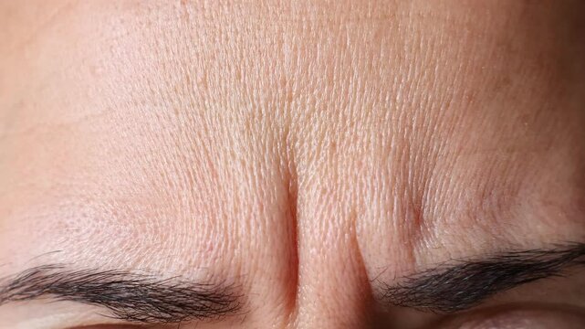 Close up view of woman forehead. Macro shot of middle aged female wrinkles. Concept of aging, old skin of wrinkled face of caucasian. Beauty portrait.