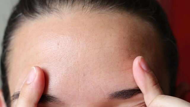 Close upview of woman forehead. Macro shot of middle aged female wrinkles. Concept of aging, old skin of wrinkled face of caucasian. Beauty portrait.