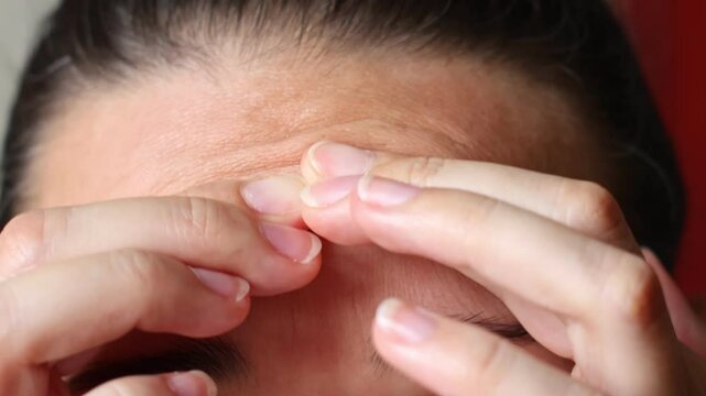 Close upview of woman forehead. Macro shot of middle aged female wrinkles. Concept of aging, old skin of wrinkled face of caucasian. Beauty portrait.