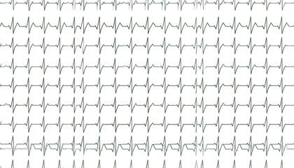 A repeating pattern of stylized electrocardiogram heartbeats in muted green on a white background, creating a textured visual effect