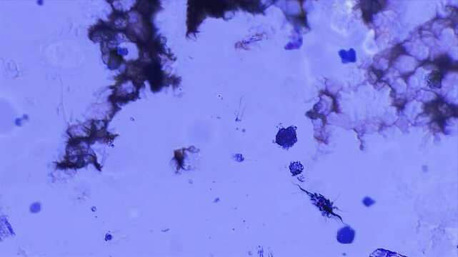 Looking Through Microscope At Microbiology Research Laboratory. Moving Biological Organism On Purple Background. Studding Biological Organism With Scaled View. Investigation Of Biological Organism.