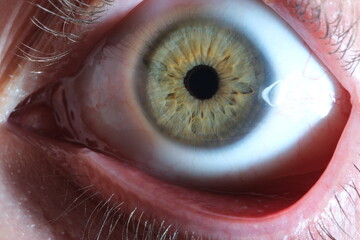 green colored eye iris