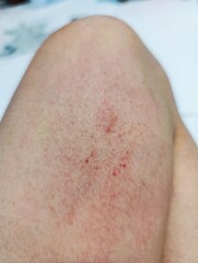 close up of a patient