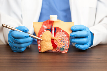 A pulmonologist explains lung diseases using an anatomical model showing the alveoli. Medical...