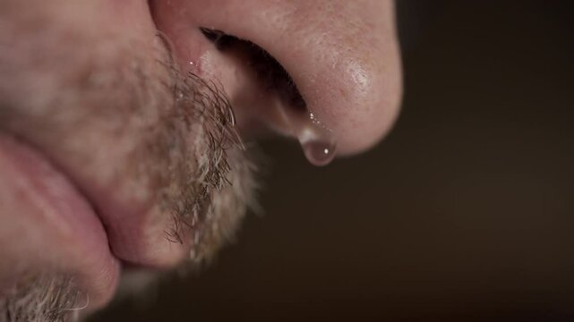 Liquid running out of a nose of middle aged man 