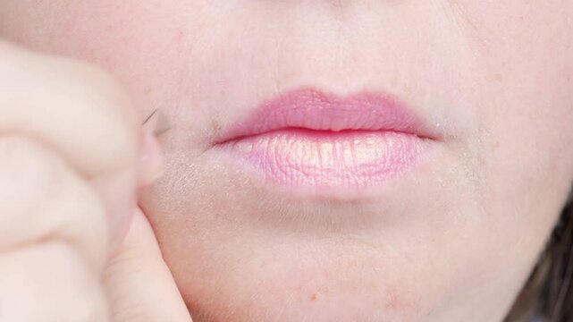 mature female lips, removes with metal tweezers excess facial hair, excessive hair growth, problem depilation on face, hormonal disorder during menopause