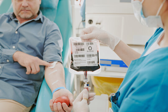 Middle aged Caucasian man donating blood while nurse wearing gloves holding blood bag and monitoring collection process in medical facility, patient squeezing stress ball during procedure - Powered by Adobe