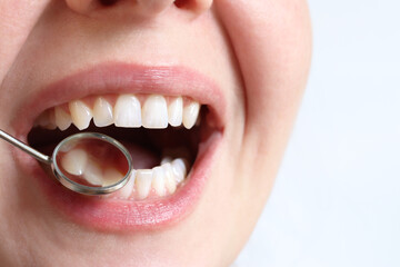 Smiling woman at the dentist, close-up. Dental mirror. Dentist examines patient's teeth with a dental mirror. Dentistry and oral hygiene concept. Real white teeth, not veneers. Close-up of teeth