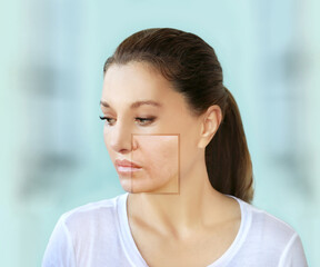 Signs of skin aging,signs of premature aging, Wrinkles and fine lines,Age spots,Sagging skin,Dehydrated skin,eyelid area