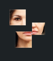 Signs of skin aging,signs of premature aging, Wrinkles and fine lines,Age spots,Sagging skin,Dehydrated skin,eyelid area