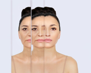 Signs of skin aging,signs of premature aging, Wrinkles and fine lines,Age spots,Sagging skin,Dehydrated skin,eyelid area