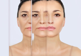 Signs of skin aging,signs of premature aging, Wrinkles and fine lines,Age spots,Sagging skin,Dehydrated skin,eyelid area