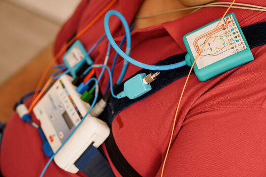 Polysomnography Setup on a Patient Chest: ECG Monitoring, Sleep Study Technology, Orange Cables, Blue Device, Medical Equipment, Healthcare Scene