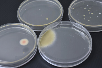 Colonies of bacteria growth on agar plate medium in laboratory.