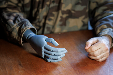 military veteran showing prosthetic hand