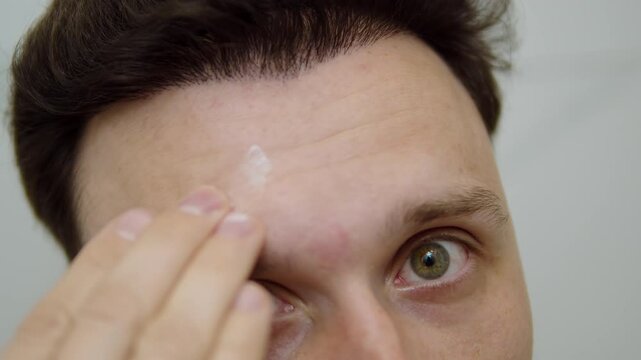 Man applying skincare cream to forehead wrinkles