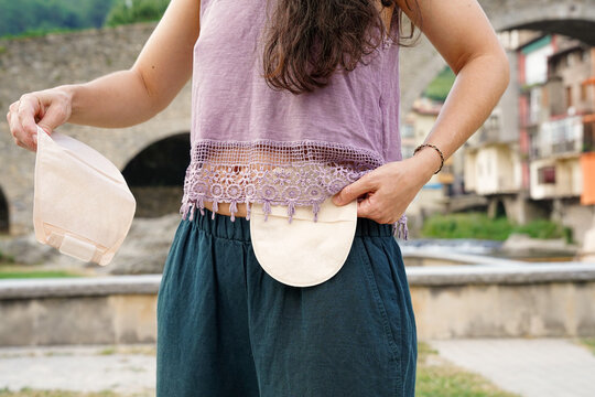 Unrecognizable woman showing a colostomy and ileostomy bag outside